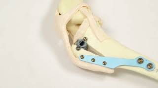 Stifle Surgery Using The Forkless TTA Procedure Veterinary Instrumentation Technique Overview [upl. by Remde]