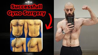 My Entire Gynecomastia Surgery Experience Plus Dos amp Donts [upl. by Eyaj]