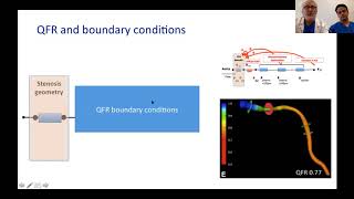 QFR influenced by microcirculatory dysfunction 2018 [upl. by Oidualc]