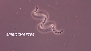 Spirochetes seen through a compound microscope [upl. by Dahsra211]