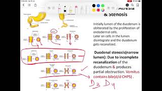 Development of Duodenum [upl. by Imyaj]