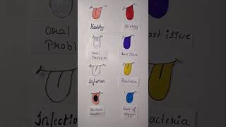 What is your tongue 👅 colour disease learning shorts [upl. by Valene]