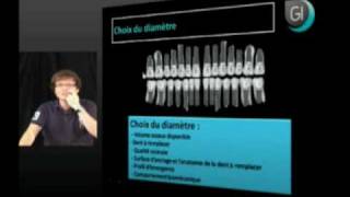 Implant dentaire  Exercice de planification  Edentement partiel [upl. by Niessuh]