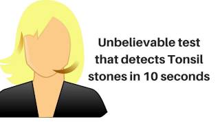 unbelievable test that detects hidden tonsil stones in 10 seconds [upl. by Yllen348]