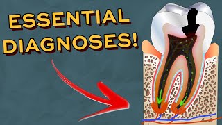 Every Dentistry Diagnoses you NEED to know when seeing patients [upl. by Aroon388]