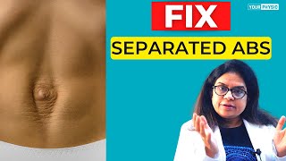 Diastasis Recti Exercises  Physical Therapy Diastasis Repair Exercises [upl. by Anirdnaxela]