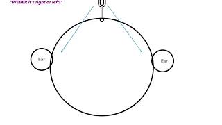 Weber vs Rinne Test amp Conductive vs Sensorineural Hearing Loss [upl. by Ssej711]