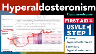 Hyperaldosteronism in HindiUrdu by first aid for USMLE step 1 [upl. by Llenehc227]