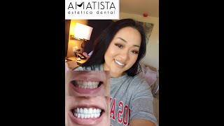 Vlog1 Getting veneers at Amatista Estetica Dental veeners amatista [upl. by Nasho]