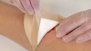 Wound Dressing Practice procedure and practice without patientwounddressing [upl. by Htebazie234]