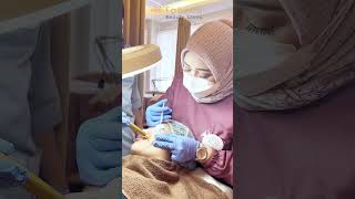 Treatment at Fabella Beauty Clinic Depok 1k skincare skinclinic beautyclinic [upl. by Chader]