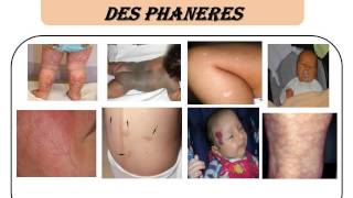 PEDIATRIE Examen clinique du nourrisson [upl. by Ilat]