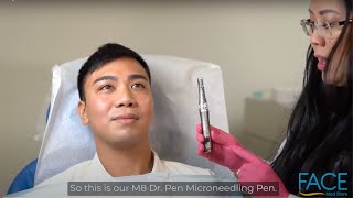 How to Use M8 Microneedling Dr Pen [upl. by Kerat441]