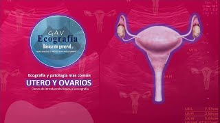 patologia basica mas comun del utero y ovarios por ecografia [upl. by Llerat510]