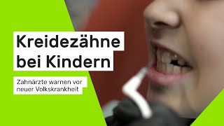 Kreidezähne bei Kindern Zahnärzte warnen vor neuer Volkskrankheit [upl. by Anjela]