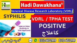 Vdrl test kya hota hai in urdu  hidni  Vdrl Positive Treatment  Vdrl negative kaise hota hai [upl. by Feucht649]