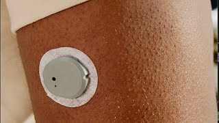 A 15day Dexcom G7 CGM is Coming dexcomg7 cgm diabetes [upl. by Ymmac764]