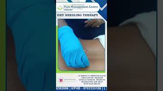 Dry Needling Therapy [upl. by Anailuj]