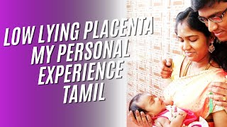 Low lying my personal experience Tamil நஞ்சுக்கொடி இரகம்1st pregnancy baby gender boy [upl. by Trebla]