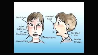 Mouth Breathing Changes your face [upl. by Chem278]