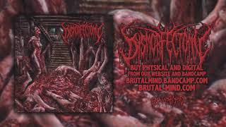 DYSMORFECTOMY  Grating of flesh  Brutal Mind [upl. by Romelle996]