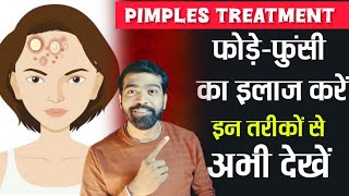 Remove Pimples PERMANENTLY in Just 4 Days 🔥 Best Home Remedies That ACTUALLY Work [upl. by Htehpaj]