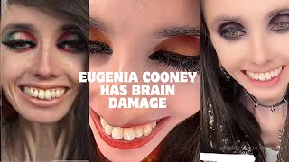 EUGENIA COONEY HAS BRAIN DAMAGE eugeniacooney eugenia eugeniacooneycontroversy [upl. by Kreg628]