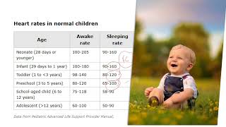 CSCWebinar 016 Les tachycardies à QRS large enfant et adulte [upl. by Meara]