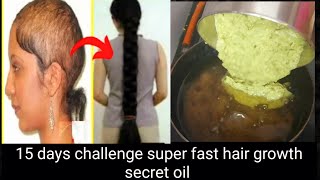 15 days challenge super fast hair growth secret oil [upl. by Niliak]