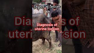 Degree of uterine torsion l dr Umar khan [upl. by Eesac]