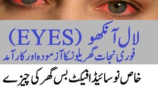 Ankho Ki Surkhi or LAL Pan Ka Ilaj  Infection eyes Redness in eyes Home Remedies for eye pain [upl. by Maclay]