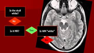 Introduction to Imaging What am I looking at [upl. by Dreddy]