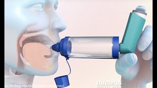 How to Use a Metered Dose Inhaler with a Spacer [upl. by Dwyer]