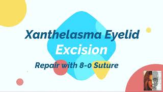 Xanthelasma Eyelid Excision [upl. by Zuzana]