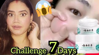 Wow 😲 CHALLENGE 7 DaysOMI White Cream Advanced Whitening amp Brighting✨ Cream [upl. by Steinway506]