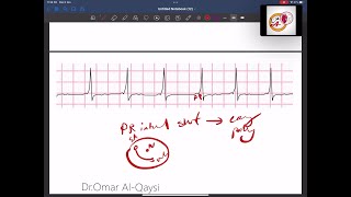 ECG interpretation the basics │ اساسيات تخطيط القلب [upl. by Yruj]