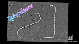 Spirochetes explained in tamil Handwritten notes in Englishmedical microbiology bacteriology [upl. by Naor]