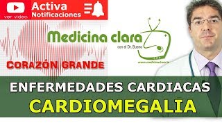 Cardiomegalia  Problemas de tener un corazón grande  Enfermedad del corazón [upl. by Neelak883]