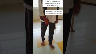 Physical DiagnosisHemiparesisRightcvastroke hemiphysiotherapylearningrehabilitationshorts [upl. by Amimej]