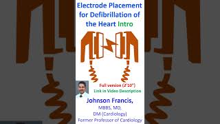 Electrode Placement for Defibrillation of the Heart [upl. by Aekahs]