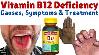 Vitamin B12 Deficiency – Symptoms Causes Diagnosis Treatment amp Prevention  Cobalamin Deficiency [upl. by Lefkowitz735]