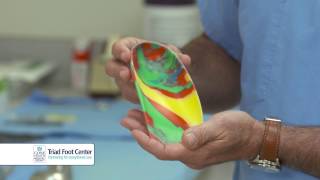 Types Of Custom Orthotics [upl. by Layman]