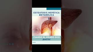 Esteatosis hepática metabólica [upl. by Dolora]