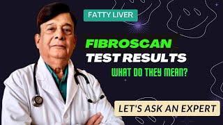 Liver FibroScan Test Results  Fatty Liver  Fibroscan of Liver Normal Range  Fatty Liver Treatment [upl. by Charlene298]