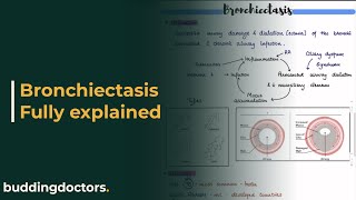 Bronchiectasis  definition etiology pathophysiology types diagnosis and treatment [upl. by Angie]