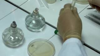 Antifungal Susceptibility Test [upl. by Glorianna]