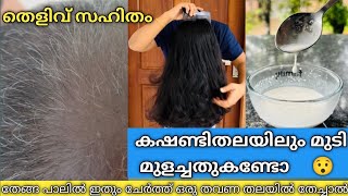 ഒരു തവണ scalp ഇൽ തേച്ചു മുടി ഇങ്ങനെ കഴുകിയാൽമതി Extreme Hair growth  Zero Hairfall alpsgoodness [upl. by April]