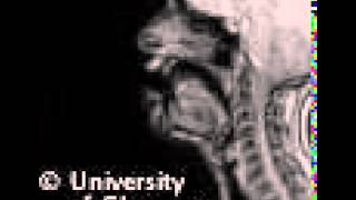 MRI voiced alveolar approximant [upl. by Helman178]