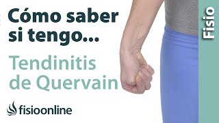 Cómo saber si tienes TENDINITIS de QUERVAIN o tendinitis del pulgar [upl. by Selrhc]