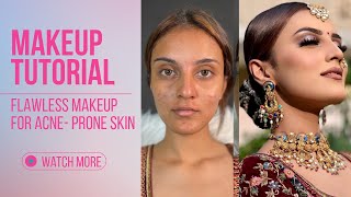 Makeup Tutorial For Acne Skin  Makeup Tutorial Step by Step  KBR MAKEOVER [upl. by Kahle]